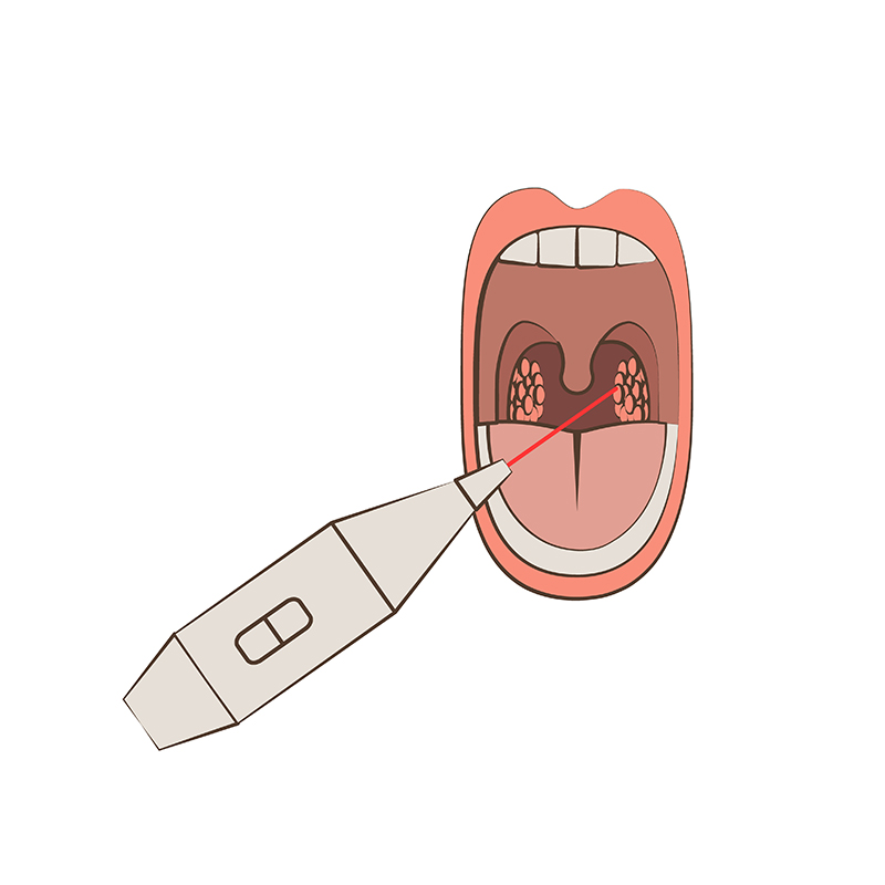 Tonsillectomy