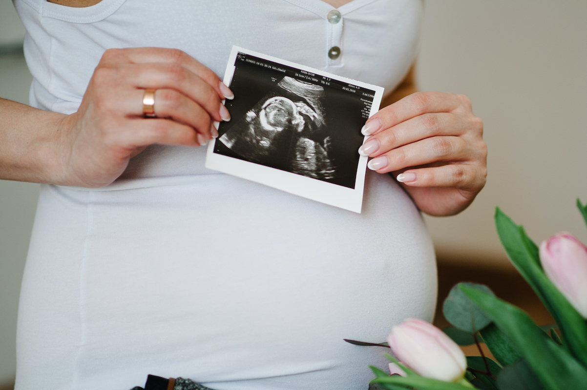 4D scans of the fetus