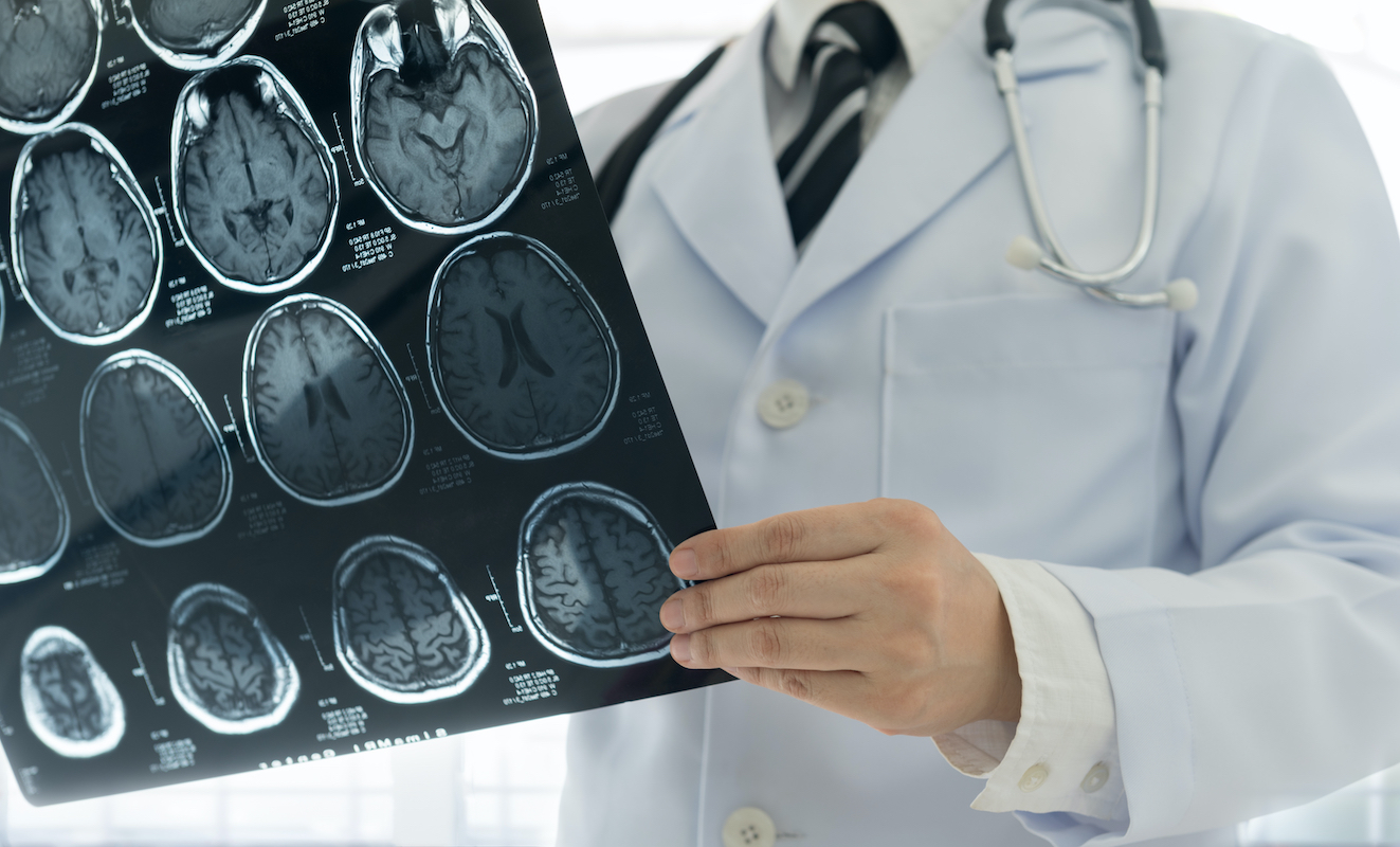 X-rays, MRIs and CT scans